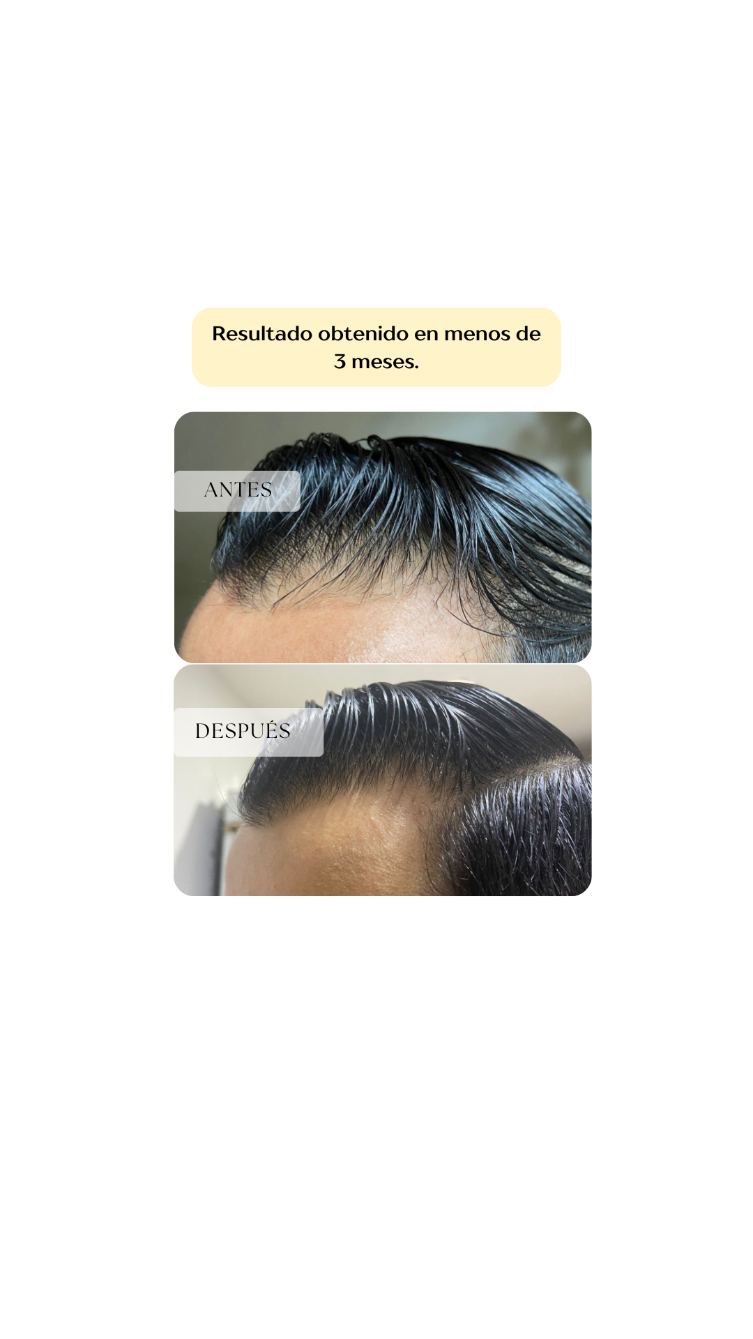 Shampoo Bergamota & Romero
