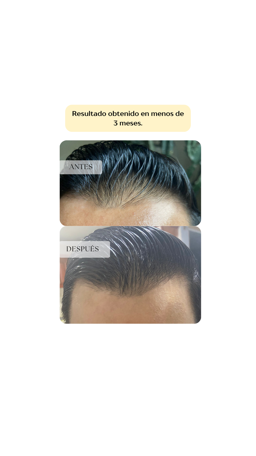 Shampoo Bergamota & Romero